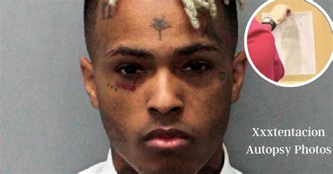 xxx autopsy leak|Jahseh Onfroy (XXXTentacion) Autopsy Report